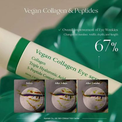 Axis-Y Vegan Collagen Roller Eye Essence (10ml), 1/2/3pcs Set, Reduces Eye Wrinkles Bags Puffiness Dark Circles